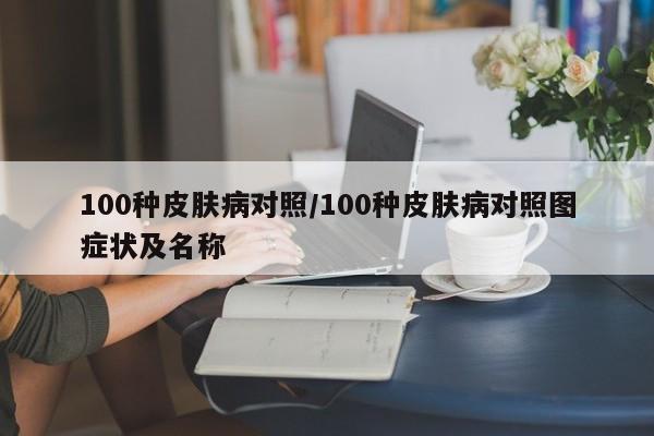 100种皮肤病对照/100种皮肤病对照图症状及名称