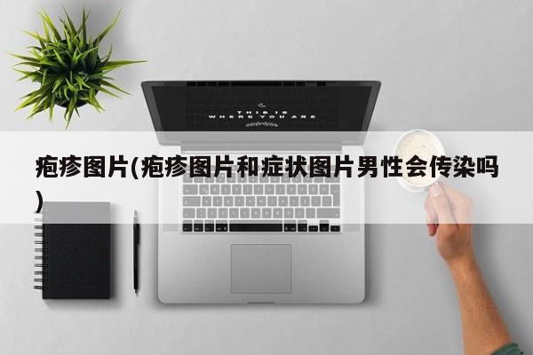 疱疹图片(疱疹图片和症状图片男性会传染吗)