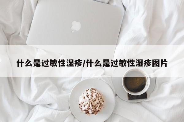 什么是过敏性湿疹/什么是过敏性湿疹图片